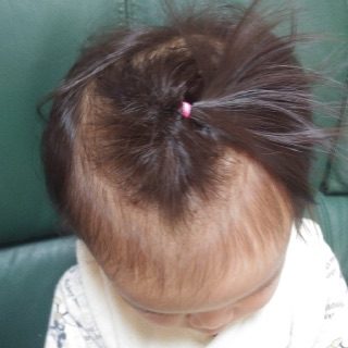 赤ちゃんのヘアゴムの結び方 薄毛ちゃんの女の子向け写真つきで紹介